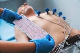 رسم القلب الكهربائي (ECG)